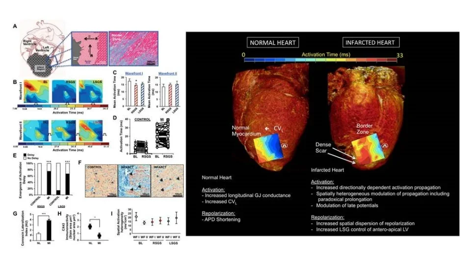 Comparison of electrical activation in normal versus infarcted hearts.