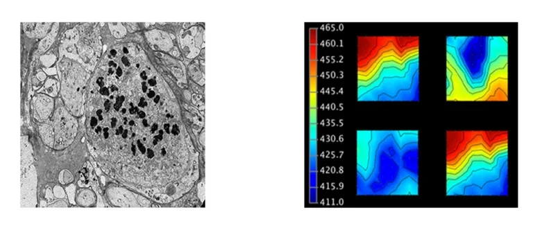 High-resolution electron micrograph of a neuronal cell with dense-core vesicles and electrical activation maps.