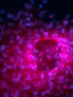 Fluorescent microscopy image showing clustered cells in bright pink and blue hues.