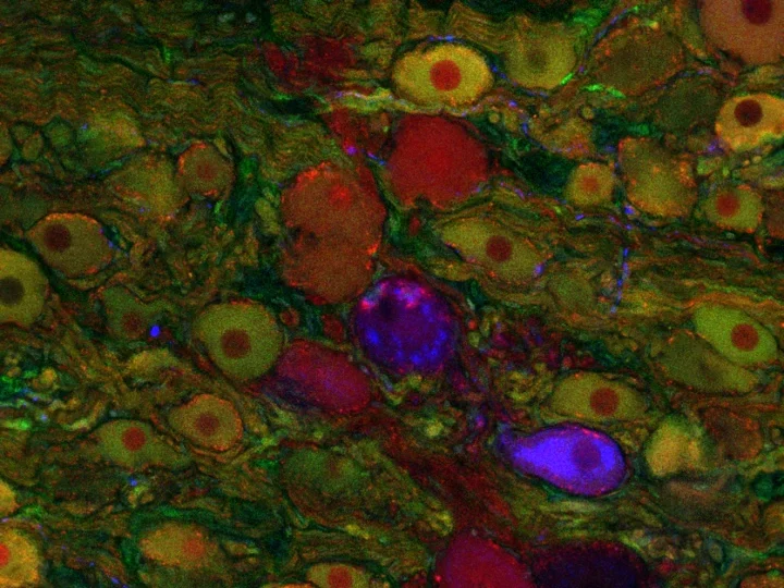 Colorful fluorescent microscopy image showing various cell types in red, green, yellow, and purple.