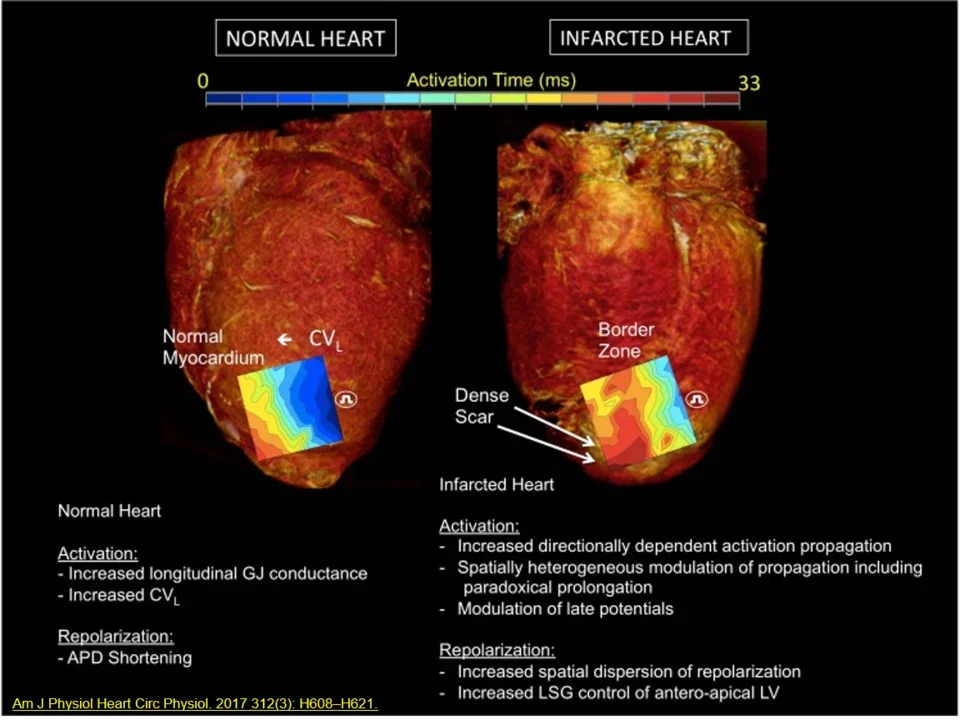 Compares the activation and repolarization characteristics of a normal heart versus an infarcted heart using activation time mapping.